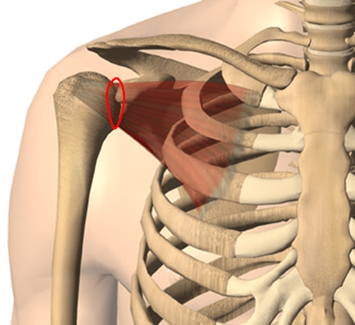 Shoulder pain series Labral Tear (SLAP Lesion)